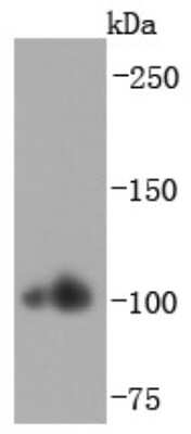 Western Blot: Alpha Actinin 2 Antibody (JF0980) [NBP2-67143] - Analysis of ACTN2 on human heart lysates using anti-ACTN2 antibody at 1/1,000 dilution.