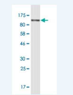 Western Blot: Alpha Actinin 4 Antibody (8G12) [H00000081-M06] - Detection against Immunogen (131.3 KDa) .