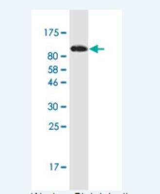 Western Blot: Alpha Actinin 4 Antibody (8G4) [H00000081-M15-100ug] - Detection against Immunogen (131.3 KDa) .