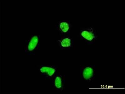 Immunocytochemistry/Immunofluorescence: Alpha Actinin 4 Antibody [H00000081-D01P] - Analysis of rabbit antibody to ACTN4 on HeLa cell. Antibody concentration 10 ug/ml.