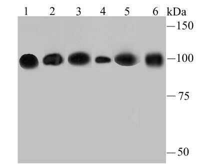 Western Blot: Alpha Actinin 4 Antibody (JU20-23) [NBP2-75404] - Analysis of alpha Actinin 4 on different lysates using anti-alpha Actinin 4 antibody at 1/500 dilution.Positive control:Lane 1: Hela      Lane 2: PC-12Lane 3: NIH-3T3   Lane 4: Rat liver tissueLane 5: A431      Lane 6: HepG2