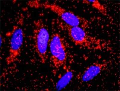 Proximity Ligation Assay: Alpha Actinin 4 Antibody [H00000081-D01P] - Analysis of protein-protein interactions between ACTN4 and CTNNB1. HeLa cells were stained with anti-ACTN4 rabbit purified polyclonal 1:1200 and anti-CTNNB1 mouse monoclonal antibody 1:50. Each red dot represents the detection of protein-protein interaction complex, and nuclei were counterstained with DAPI (blue).