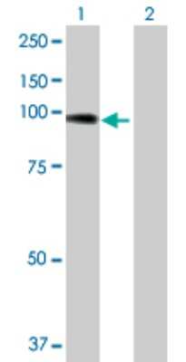 Western Blot: Alpha Actinin 4 Antibody [H00000081-D01P] - Analysis of ACTN4 expression in transfected 293T cell line by ACTN4 polyclonal antibody.Lane 1: ACTN4 transfected lysate(104.90 KDa).Lane 2: Non-transfected lysate.