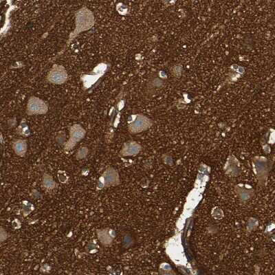 Immunohistochemistry-Paraffin: Alpha Fodrin Antibody [NBP1-89460] - Staining of human cerebral cortex shows strong positivity in neuropil.