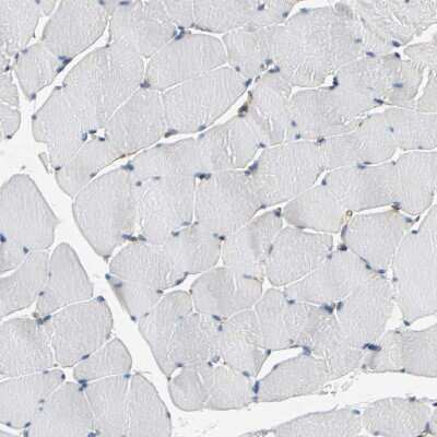 Immunohistochemistry-Paraffin: Alpha Fodrin Antibody [NBP1-89460] - Staining of human skeletal muscle shows no cytoplasmic positivity in myocytes as expected.