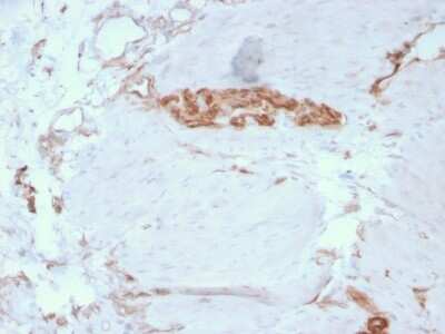 Immunohistochemistry-Paraffin: Alpha Fodrin Antibody (SPTAN1/3351) [NBP3-08347] - Formalin-fixed, paraffin-embedded human Colon stained with Alpha Fodrin Mouse Monoclonal Antibody (SPTAN1/3351).