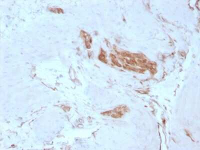 Immunohistochemistry-Paraffin: Alpha Fodrin Antibody (SPTAN1/3351) [NBP3-08347] - Formalin-fixed, paraffin-embedded human Tonsil stained with Alpha Fodrin Mouse Monoclonal Antibody (SPTAN1/3351).