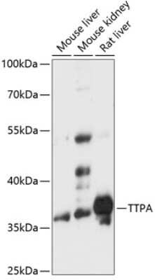 Western Blot: Alpha-TTP Antibody [NBP2-92170] - Analysis of extracts of various cell lines, using Alpha-TTP at 1:3000 dilution. Secondary antibody: HRP Goat Anti-Rabbit IgG (H+L) at 1:10000 dilution. Lysates/proteins: 25ug per lane. Blocking buffer: 3% nonfat dry milk in TBST. Detection: ECL Basic Kit . Exposure time: 30s.