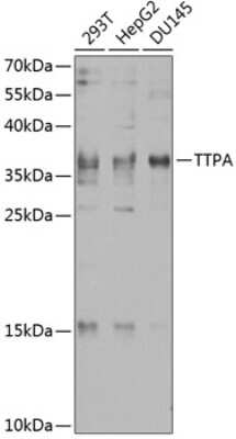 Western Blot: Alpha-TTP Antibody [NBP2-92559] - Analysis of extracts of various cell lines, using Alpha-TTP . Exposure time: 60s.