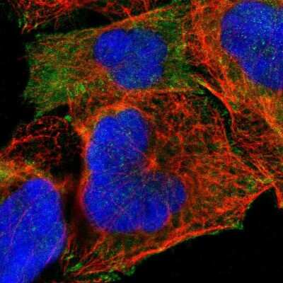 Immunocytochemistry/Immunofluorescence: Alpha-parvin/Actopaxin Antibody [NBP1-87912] - Immunofluorescent staining of human cell line A-431 shows localization to cytosol, actin filaments & focal adhesion sites.