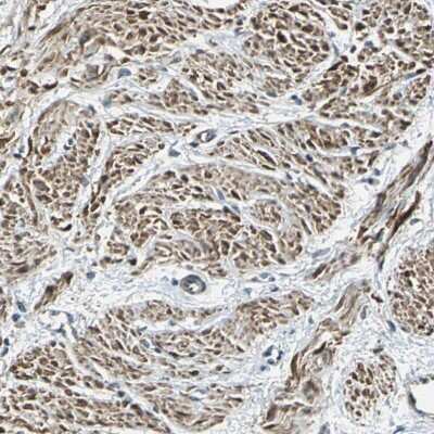 Immunohistochemistry-Paraffin: Alpha-parvin/Actopaxin Antibody [NBP1-87912] - Staining of human smooth muscle shows cytoplasmic positivity in smooth muscle cells.