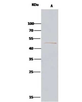 Immunoprecipitation: Alpha-parvin/Actopaxin Antibody [NBP3-00222] - Alpha-parvin/Actopaxin was immunoprecipitated using: Lane A: 0.5 mg HepG2 Whole Cell Lysate. 2 ul anti-Alpha-parvin/Actopaxin rabbit polyclonal antibody and 15 ul of 50 % Protein G agarose. Primary antibody: Anti-Alpha-parvin/Actopaxin rabbit polyclonal antibody, at 1:200 dilution. Secondary antibody: Clean-Bloto IP Detection Reagent (HRP) at 1:1000 dilution. Developed using the DAB staining technique. Performed under reducing conditions. Predicted band size: 50 kDa. Observed band size: 50 kDa