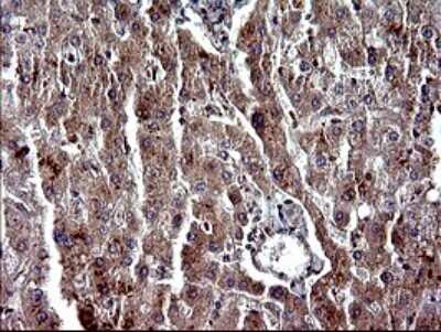 Immunohistochemistry: Alpha-parvin/Actopaxin Antibody (OTI1C10) [NBP2-46326] - Analysis of Human liver tissue. (Heat-induced epitope retrieval by 10mM citric buffer, pH6.0, 120C for 3min)