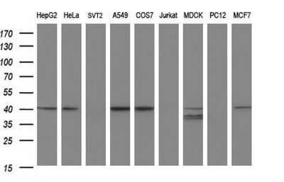 Western Blot: Alpha-parvin/Actopaxin Antibody (OTI1C10) [NBP2-46326] - Analysis of extracts (35ug) from 9 different cell lines by using PARVA monoclonal antibody (HepG2: human; HeLa: human; SVT2: mouse; A549: human; COS7: monkey; Jurkat: human; MDCK: canine; PC12: rat; MCF7: human).