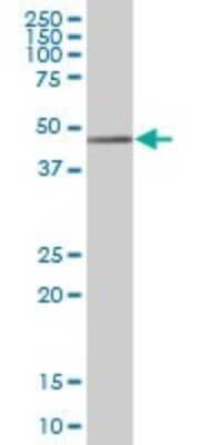 Western Blot: Alpha-parvin/Actopaxin Antibody [H00055742-B01P] - Analysis of PARVA expression in human stomach.