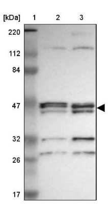 Western Blot: Alpha-parvin/Actopaxin Antibody [NBP1-87912] - Lane 1: Marker  [kDa] 220, 112, 84, 47, 32, 26, 17.  Lane 2: Human cell line RT-4.  Lane 3: Human cell line U-251MG sp