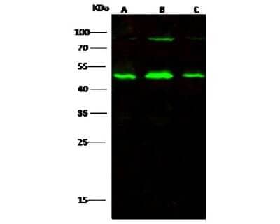 Western Blot: Alpha-parvin/Actopaxin Antibody [NBP3-00222] - Anti-Alpha-parvin/Actopaxin rabbit polyclonal antibody at 1:500 dilution. Lane A: HepG2 Whole Cell Lysate. Lane B: A549 Whole Cell Lysate. Lane C: MCF7 Whole Cell Lysate. Lysates/proteins at 30 ug per lane. Secondary Goat Anti-Rabbit IgG H&L (Dylight 800) at 1/10000 dilution. Developed using the Odyssey technique. Performed under reducing conditions. Predicted band size: 47 kDa. Observed band size: 48 kDa (We are unsure as to the identity of these extra bands).