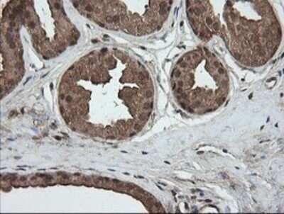 Immunohistochemistry: AlphaA Crystallin/CRYAA Antibody (OTI3B12) - Azide and BSA Free [NBP2-70450] - Analysis of Human breast tissue.