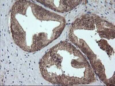 Immunohistochemistry: AlphaA Crystallin/CRYAA Antibody (OTI3B12) - Azide and BSA Free [NBP2-70450] - Analysis of Human prostate tissue.