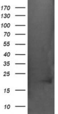 Western Blot: AlphaA Crystallin/CRYAA Antibody (OTI3B12) - Azide and BSA Free [NBP2-70450] - Analysis of HEK293T cells were transfected with the pCMV6-ENTRY control (Left lane) or pCMV6-ENTRY CRYAA.