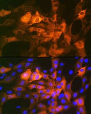 Immunocytochemistry/Immunofluorescence: AlphaB Crystallin/CRYAB Antibody (6C9R1) [NBP3-16844] - Immunofluorescence analysis of C6 cells using AlphaB Crystallin/CRYAB Rabbit mAb (NBP3-16844) at dilution of 1:100 (40x lens). Blue: DAPI for nuclear staining.