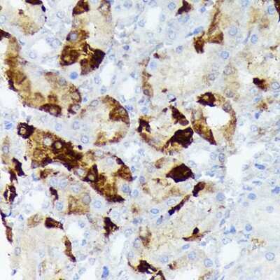 Immunohistochemistry-Paraffin: AlphaB Crystallin/CRYAB Antibody (6C9R1) [NBP3-16844] - Immunohistochemistry of paraffin-embedded rat kidney using AlphaB Crystallin/CRYAB Rabbit mAb (NBP3-16844) at dilution of 1:100 (40x lens).Perform microwave antigen retrieval with 10 mM Tris/EDTA buffer pH 9.0 before commencing with IHC staining protocol.