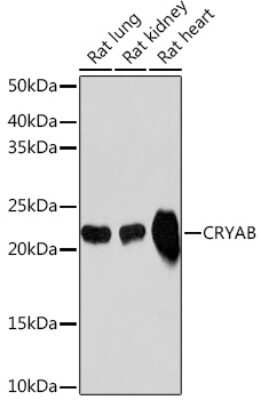 Western Blot: AlphaB Crystallin/CRYAB Antibody (6C9R1) [NBP3-16844] - Western blot analysis of extracts of various cell lines, using AlphaB Crystallin/CRYAB Rabbit mAb (NBP3-16844) at 1:1000 dilution. Secondary antibody: HRP Goat Anti-Rabbit IgG (H+L) at 1:10000 dilution. Lysates/proteins: 25ug per lane. Blocking buffer: 3% nonfat dry milk in TBST. Detection: ECL Basic Kit. Exposure time: 30s.