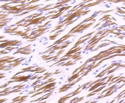 Immunohistochemistry-Paraffin: AlphaB Crystallin/CRYAB Antibody (JA50-32) [NBP2-67149] - Analysis of paraffin-embedded human embryonic skeletal muscle tissue using anti-Alpha B Crystallin antibody. Counter stained with hematoxylin.