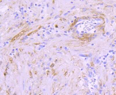 Immunohistochemistry-Paraffin: AlphaB Crystallin/CRYAB Antibody (JA50-32) [NBP2-67149] - Analysis of paraffin-embedded human prostate tissue using anti-Alpha B Crystallin antibody. Counter stained with hematoxylin.