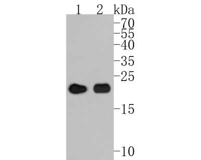 Western Blot: AlphaB Crystallin/CRYAB Antibody (JA50-32) [NBP2-67149] - Western blot analysis of AlphaB Crystallin/CRYAB on different lysates. Proteins were transferred to a PVDF membrane and blocked with 5% BSA in PBS for 1 hour at room temperature. The primary antibody (1/500) was used in 5% BSA at room temperature for 2 hours. Goat Anti-Rabbit IgG - HRP Secondary Antibody (HA1001) at 1:5,000 dilution was used for 1 hour at room temperature. Positive control: Lane 1: rat heart tissue lysate Lane 2: human skeletal muscle tissue lysate
