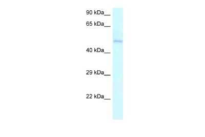 Western Blot: Ameloblastin Antibody [NBP2-88765] - WB Suggested Anti-AMBN Antibody. Titration: 1.0 ug/ml. Positive Control: Jurkat Whole Cell