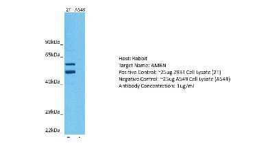 Western Blot: Ameloblastin Antibody [NBP2-88765] - Host: Rabbit. Target: AMBN. Positive control (+): 293T Cell Lysate (2T). Negative control (-): A549 Cell Lysate (N03). Antibody concentration: 1ug/ml