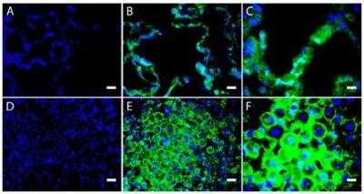 Immunocytochemistry/Immunofluorescence: Amiloride-sensitive cation channel 3 Antibody [NB100-2067] - ASIC3 expression in normal and CF human lung tissues by immunofluorescence microscopy. Normal (top panels A-C) and CF human lung sections (bottom panels D-F) were labeled with a specific antibody against ASIC3 (green channel) and the DNA-selective Hoechst dye (blue channel). A and D, normal and CF human lung sections imaged following incubation with the mixture of anti-ASIC3 antibody and immunopeptide. Shown are normal (B) and CF (E) alveolar structures at a small magnification. ASIC3 expression was detected in both types I and II alveolar cells. Shown are normal (C) and CF (F) alveolar structures at a large magnification. Scale bars equal 10 um in A, B, D, and E and 20 um in C and F.