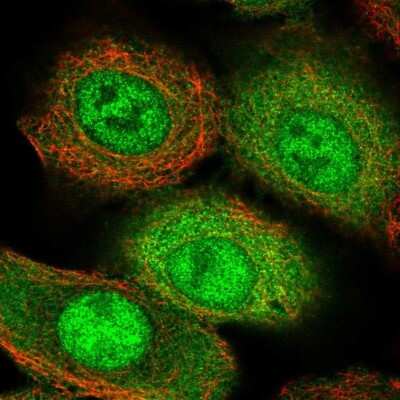 Immunocytochemistry/Immunofluorescence: Amiloride-sensitive cation channel 3 Antibody [NBP2-14322] - Immunofluorescent staining of human cell line A549 shows localization to nucleoplasm & cytosol.