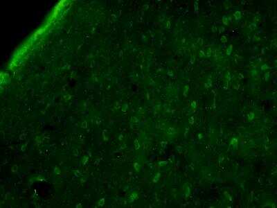 Immunocytochemistry/Immunofluorescence: Amiloride-sensitive cation channel 3 Antibody [NBP1-20095] - Rat hypothalamus stained with anti-Amiloride-sensitive cation channel 3 antibody. Image from verified customer review.