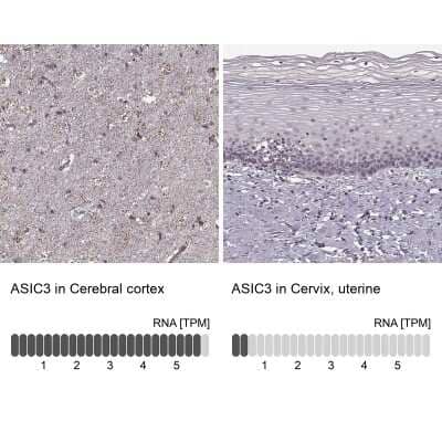 Immunohistochemistry-Paraffin: Amiloride-sensitive cation channel 3 Antibody [NBP2-62624] - Immunohistochemistry analysis in human cerebral cortex and cervix, uterine tissues using Anti-ASIC3 antibody. Corresponding ASIC3 RNA-seq data are presented for the same tissues.