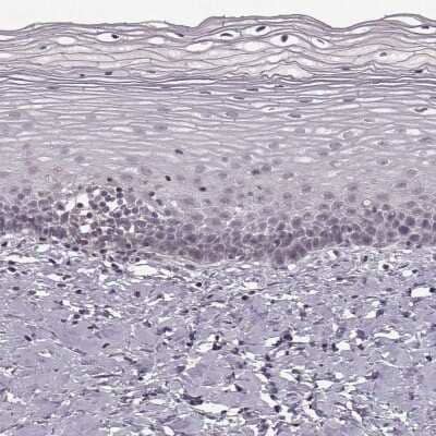 Immunohistochemistry-Paraffin: Amiloride-sensitive cation channel 3 Antibody [NBP2-62624] - Staining of human cervix, uterine shows low expression as expected.