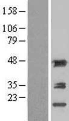 Western Blot: Aminoacylase/ACY1 Overexpression Lysate [NBL1-07300] - Left-Empty vector transfected control cell lysate (HEK293 cell lysate); Right -Over-expression Lysate for Aminoacylase 1.