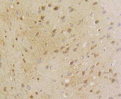 Immunohistochemistry-Paraffin: Aminoacylase/ACY1 Antibody [NBP2-89113] - Analysis of paraffin-embedded rat brain tissue using anti-ACY-1 antibody. The section was pre-treated using heat mediated antigen retrieval with Tris-EDTA buffer (pH 8.0-8.4) for 20 minutes.The tissues were blocked in 5% BSA for 30 minutes at room temperature, washed with ddH2O and PBS, and then probed with the antibody at 1/200 dilution, for 30 minutes at room temperature and detected using an HRP conjugated compact polymer system. DAB was used as the chrogen. Counter stained with hematoxylin and mounted with DPX.