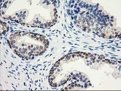 Immunohistochemistry: Aminoacylase/ACY1 Antibody (OTI1D4) - Azide and BSA Free [NBP2-70080] - Staining of paraffin-embedded Human prostate tissue using anti-Aminoacylase 1 mouse monoclonal antibody.