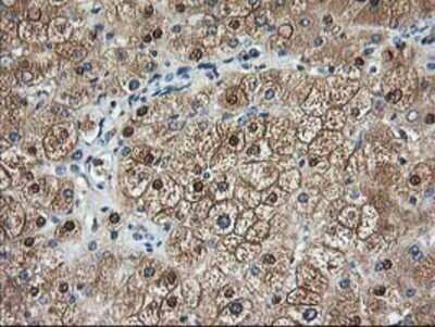 Immunohistochemistry: Aminoacylase/ACY1 Antibody (OTI1D4) - Azide and BSA Free [NBP2-70080] - Staining of paraffin-embedded Human liver tissue using anti-Aminoacylase 1 mouse monoclonal antibody.