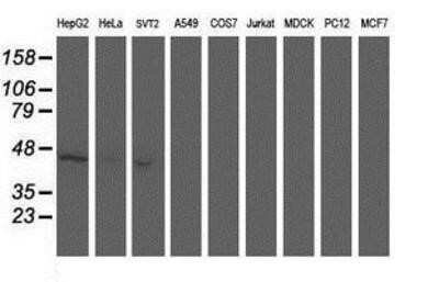 Western Blot: Aminoacylase/ACY1 Antibody (OTI1D4) - Azide and BSA Free [NBP2-70080] - Analysis of extracts (35ug) from 9 different cell lines by using anti-Aminoacylase 1 monoclonal antibody.