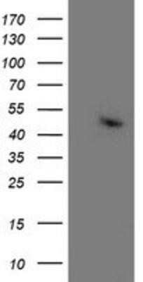 Western Blot: Aminoacylase/ACY1 Antibody (OTI1D4) - Azide and BSA Free [NBP2-70080] - HEK293T cells were transfected with the pCMV6-ENTRY control (Left lane) or pCMV6-ENTRY Aminoacylase 1 (Right lane) cDNA for 48 hrs and lysed. Equivalent amounts of cell lysates (5 ug per lane) were separated by SDS-PAGE and immunoblotted with anti-Aminoac