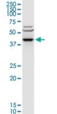 Western Blot: Aminoacylase/ACY1 Antibody [H00000095-D01P] - Analysis of ACY1 expression in MCF-7.