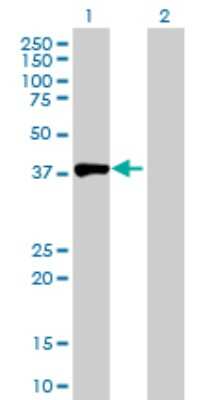 Western Blot: Aminoacylase/ACY1 Antibody [H00000095-D01P] - Analysis of ACY1 expression in transfected 293T cell line by ACY1 polyclonal antibody.Lane 1: ACY1 transfected lysate(45.90 KDa).Lane 2: Non-transfected lysate.