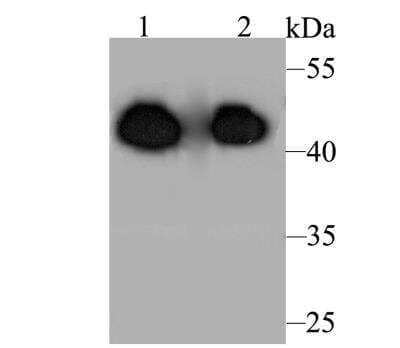Western Blot: Aminoacylase/ACY1 Antibody [NBP2-89113] - Analysis of ACY-1 on different lysates. Proteins were transferred to a PVDF membrane and blocked with 5% BSA in PBS for 1 hour at room temperature. The primary antibody was used at a 1:2,000 dilution in 5% BSA at room temperature for 2 hours. Goat Anti-Rabbit IgG - HRP Secondary Antibody at 1:5,000 dilution was used for 1 hour at room temperature.Positive control: Lane 1: Rat kidney tissue lysateLane 2: Mouse kidney tissue lysate