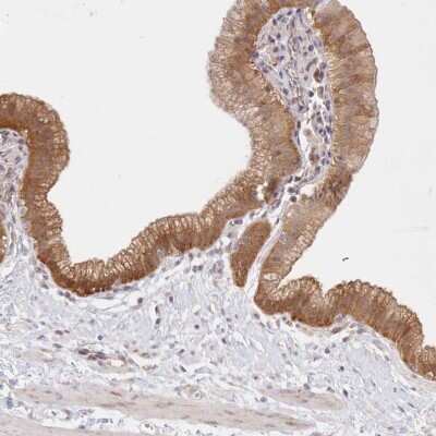 <b>Independent Antibodies Validation. </b>Immunohistochemistry-Paraffin: Aminopeptidase B/RNPEP Antibody [NBP1-85897] - Staining of human gallbladder shows moderate cytoplasmic positivity in glandular cells.