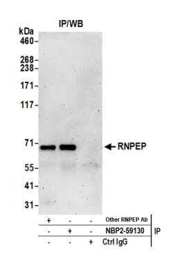 Immunoprecipitation: Aminopeptidase B/RNPEP Antibody [NBP2-59130] - Detection of human RNPEP by western blot of immunoprecipitates. Samples: Whole cell lysate (0.5 or 1.0 mg per IP reaction; 20% of IP loaded) from HeLa cells prepared using NETN lysis buffer. Antibodies: Affinity purified rabbit anti-RNPEP antibody NBP2-59130 used for IP at 8 ul per reaction. RNPEP was also immunoprecipitated by another rabbit anti-RNPEP antibody. For blotting immunoprecipitated RNPEP, NBP2-59130 was used at 1:1000. Detection: Chemiluminescence with an exposure time of 3 minutes.