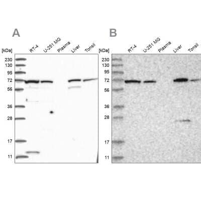 Western Blot: Aminopeptidase B/RNPEP Antibody [NBP1-85897] - Analysis using Anti-RNPEP antibody NBP1-85897 (A) shows similar pattern to independent antibody NBP2-54975 (B).