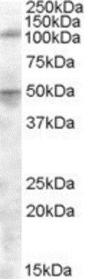 Western Blot: Aminopeptidase LRAP/ERAP2 Antibody [NBP1-20913] - (0.5ug/ml) staining of Spleen lysate (35ug protein in RIPA buffer). Primary incubation was 1 hour. Detected by chemiluminescence.